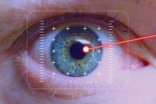 process-of-laser-eye-surgery-63c14f4b6d6ad.jpg